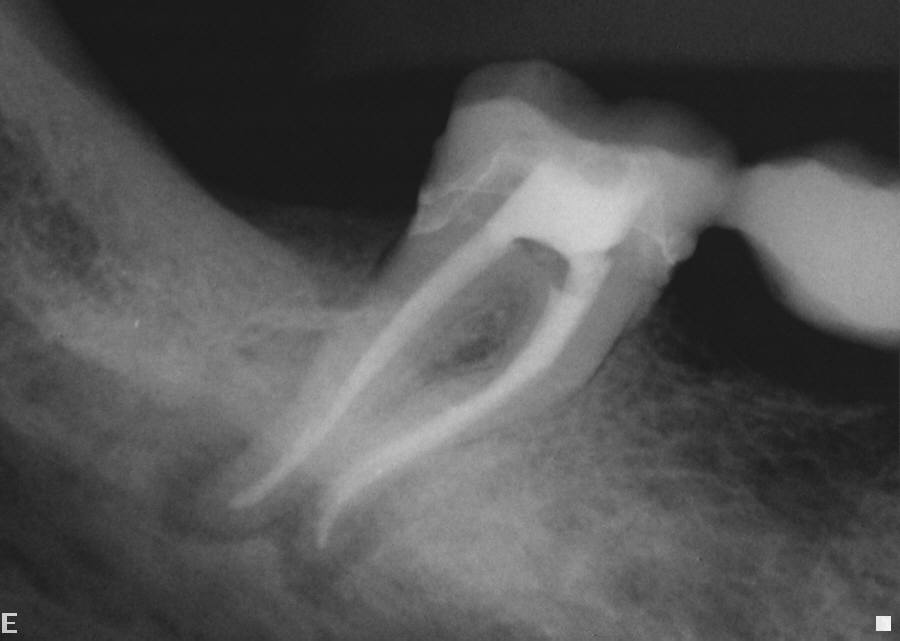 Digital X-ray Imaging